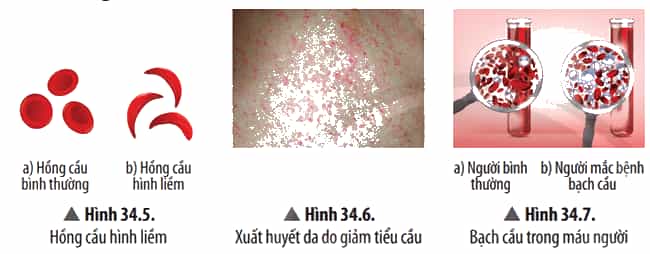 Quan sát các Hình từ 34.5 đến 34.9, hãy kể tên, nêu nguyên nhân và các biện pháp