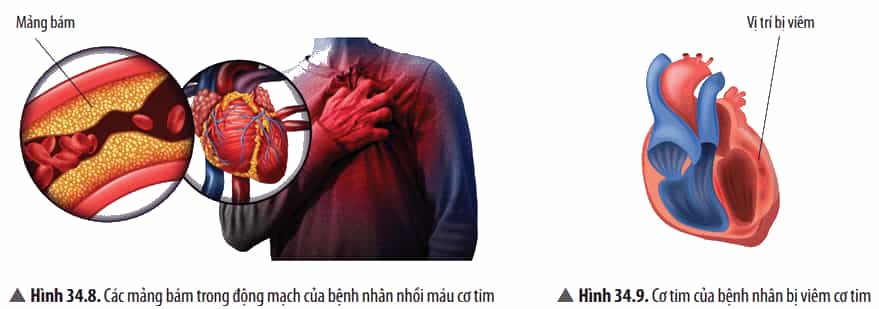 Quan sát các Hình từ 34.5 đến 34.9, hãy kể tên, nêu nguyên nhân và các biện pháp