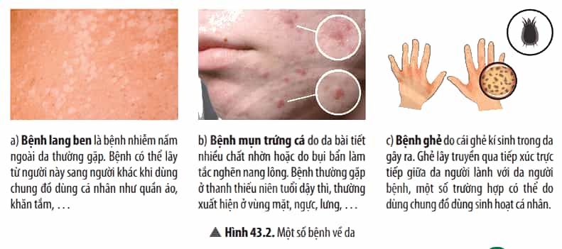 Quan sát Hình 43.2, hãy hoàn thành bảng sau